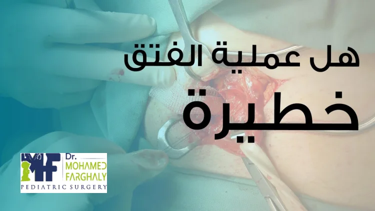 هل عملية الفتق الإربي خطيرة؟