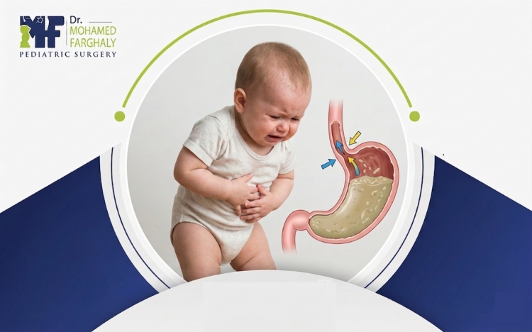 اعراض الارتجاع الصامت عند الرضع