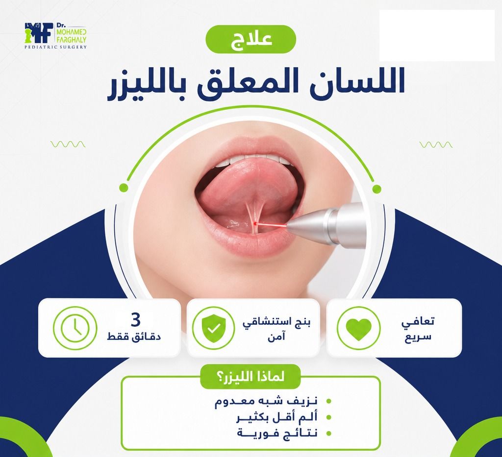 اللسان المعلق